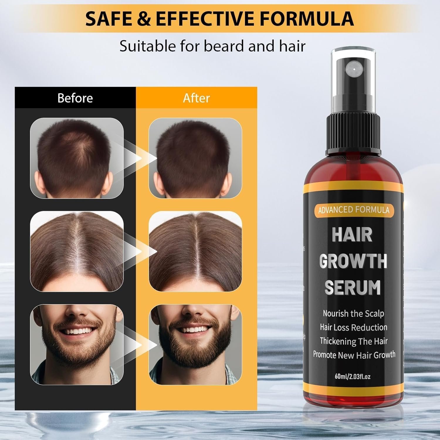 YaaHei Minoxidil 5% Men and Women Hair Growth Oil Spray, Refreshing and Easy to Manage 60ml - Image 2